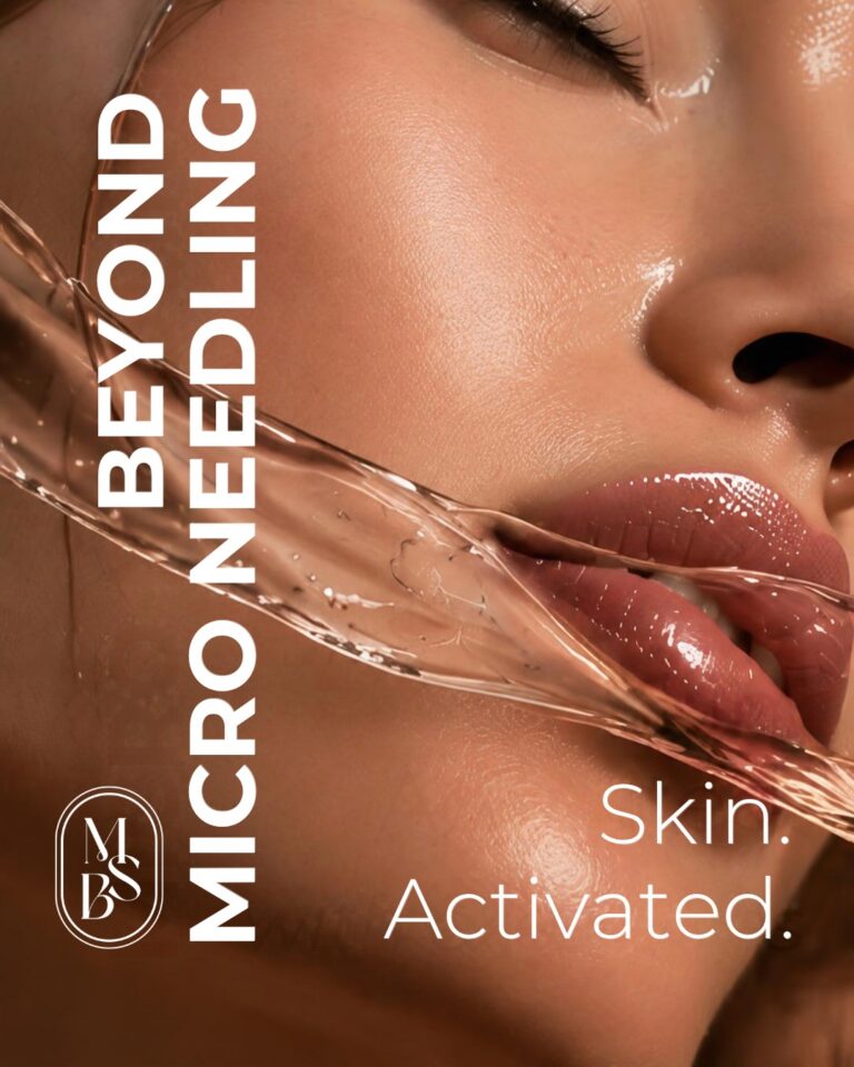 Microneedling ed esosomi: un percorso personalizzato per la qualità della pelle