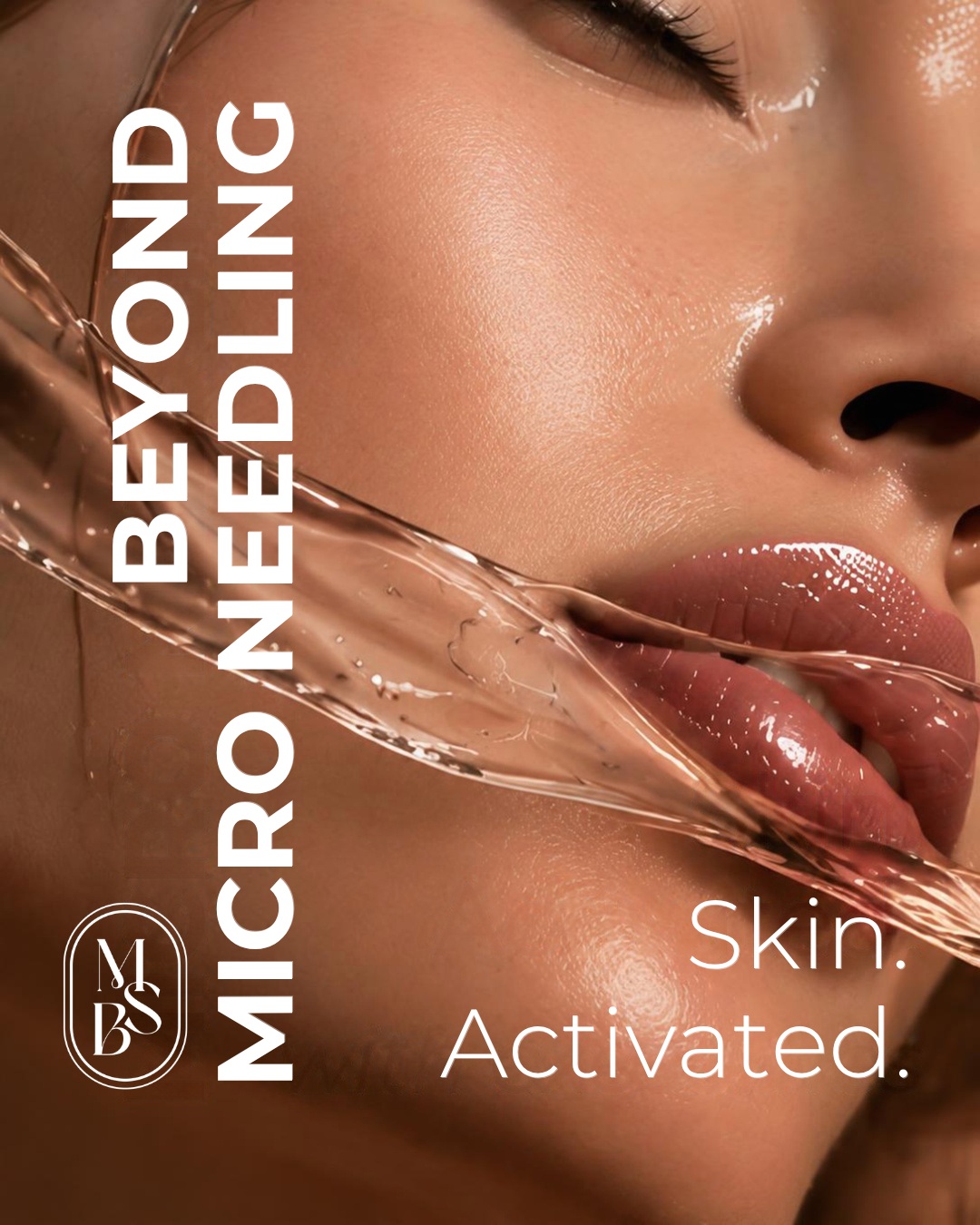 Microneedling ed esosomi: un percorso personalizzato per la qualità della pelle